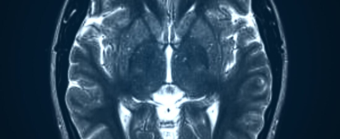 Spinal Cord Injuries and Paralysis From Truck Collisions