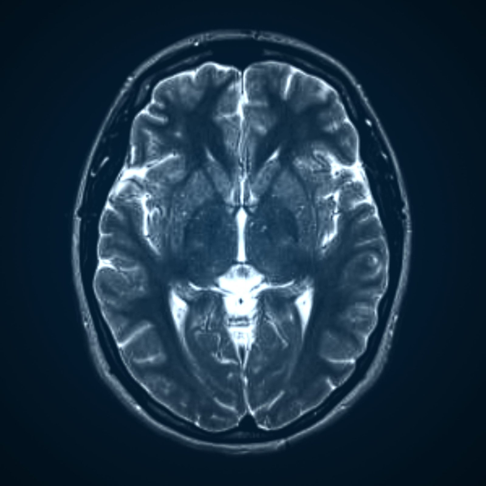Spinal Cord Injuries and Paralysis From Truck Collisions